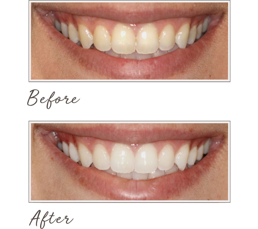 Smileactives Advanced Teeth Whitening Pen Trio - Page 1 ...